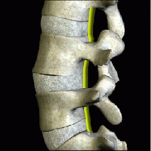 Degenerative Disc Disease (DDD) Exercises)
