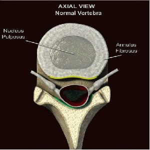 Thoracic Herniated Disc Anatomy