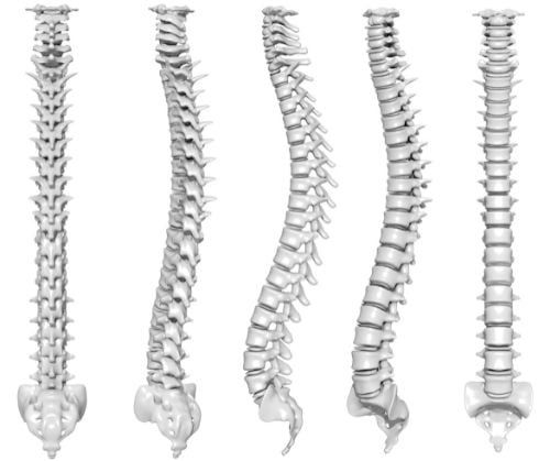 Exercises for Spinal Disc Conditions