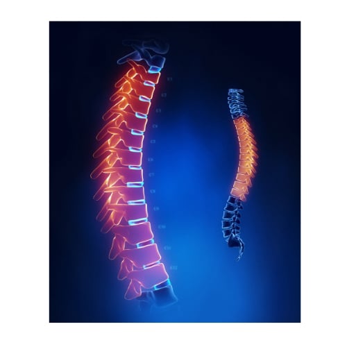 Anatomy of the Thoracic Spine